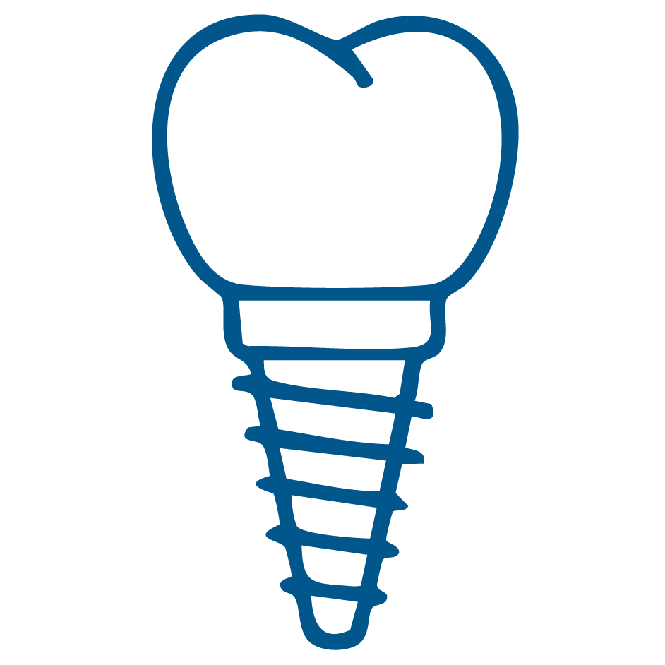 Dental Implants